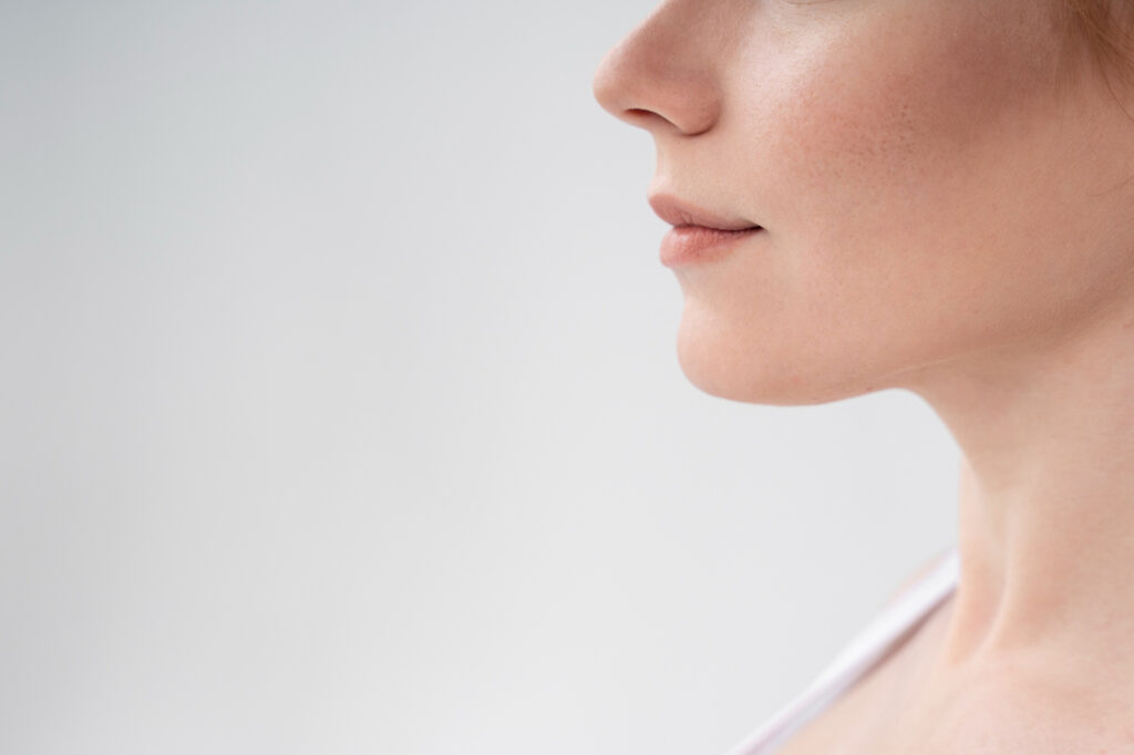 Woman about to receive cheek filler