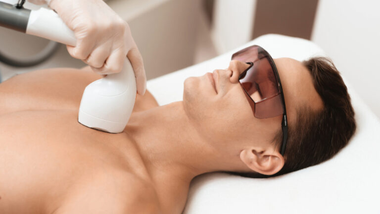 Laser Hair Removal for Men