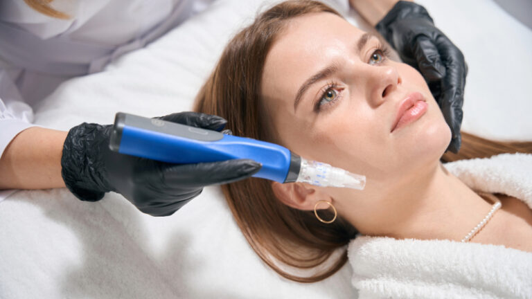 The Top Benefits of Microneedling for Your Skin