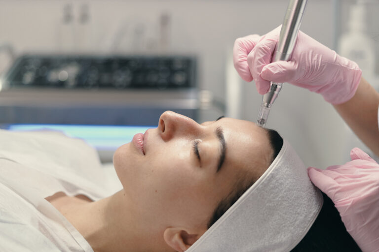 Woman receiving VAMP Advanced microneedling treatment